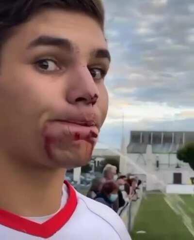 Дерьмо случается