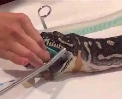 They pulled the towel out of the snake!