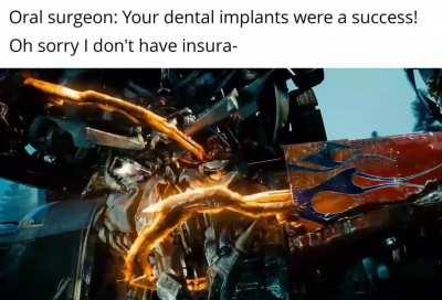 As a American I can confirm they did this to me. my head still hurts too