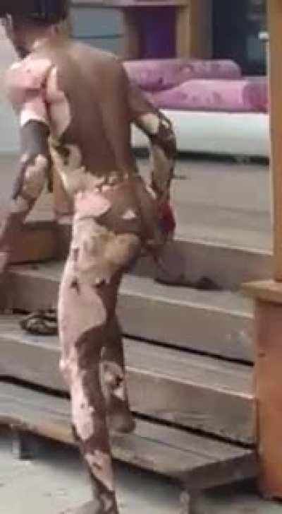 Yet another copper thief contemplates his decision to steal life wire.