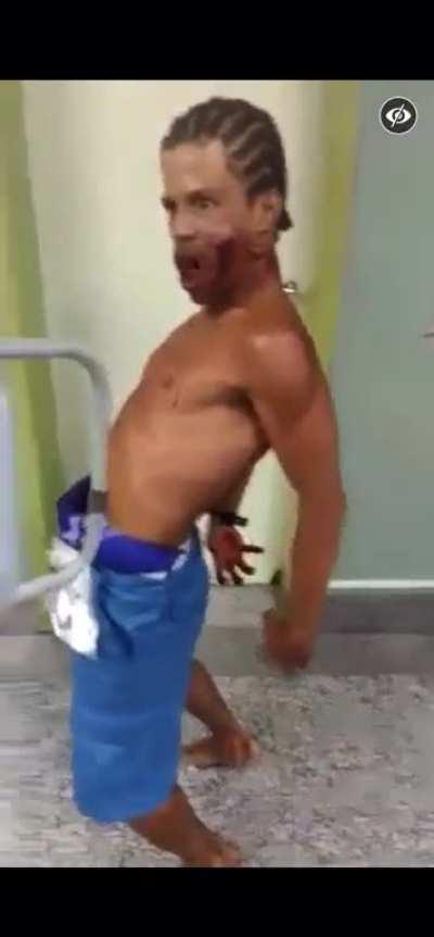 Man on PCP Shows up at Hospital with Gunshot Wound to the Face!