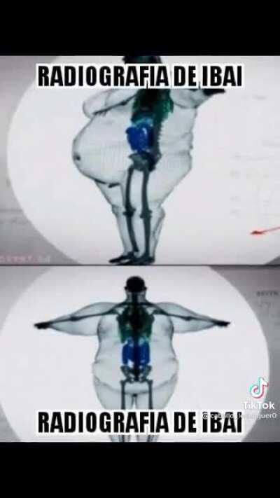 Radiografía de ibai