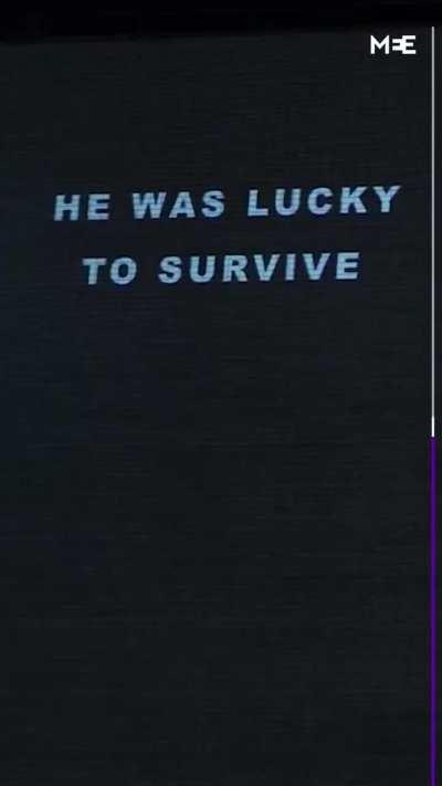 On Monday, images of injured Palestinian children, victims of Israel’s ongoing war on Gaza, were displayed on St Thomas Hospital in London, UK. Along with the images, there were texts with phrases like 'Don’t look away' and 'The children of Gaza need you,