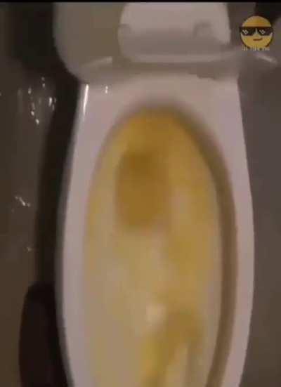 Me every 10 minutes after taking pre workout 