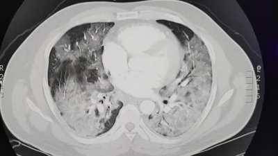 Their COVID test was 