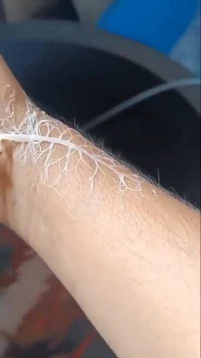 Ribbon worms are known for their proboscis growing rootlike structure that's vomited out which is designed to drag food inside.