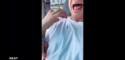 JJ after seeing a bug be like