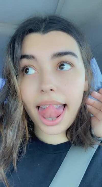 New lilac braces! What do you think? [F20]