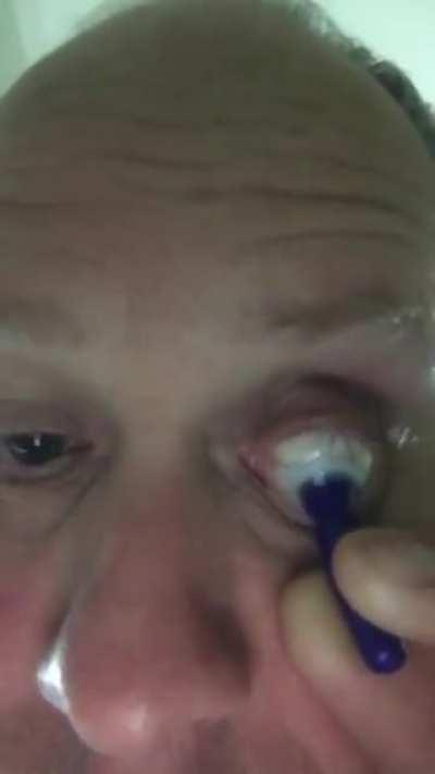 Глазной терроризм