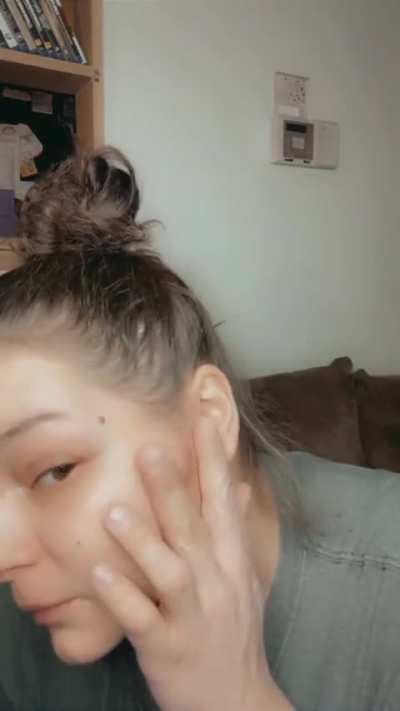 Huge pimple near to ear