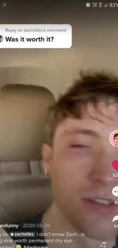 What if I pour laundry detergent on my face?