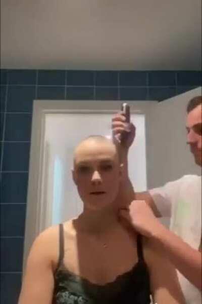 His girlfriend was struggling with her hair loss from alopecia