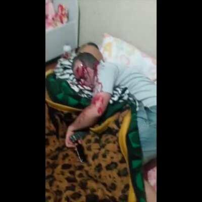 Dude gets shot in bed (graphic)