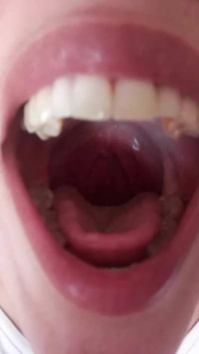 did you miss me? {f}