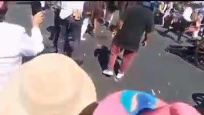 Man's hand blown off by a cannon during a parade