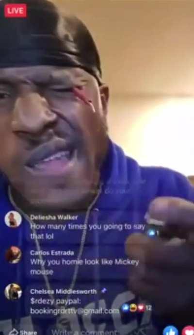 Dude lights firecracker in his eye 