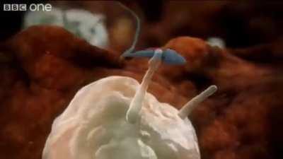 Sperm attacked by woman's immune system