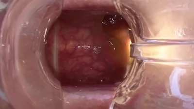 Turd Tunnels - Juelz vs Casey