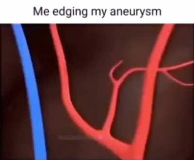 Edging my aneurysm 🧠
