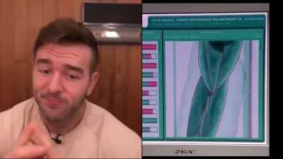 Will you ex-girlfriend regret it