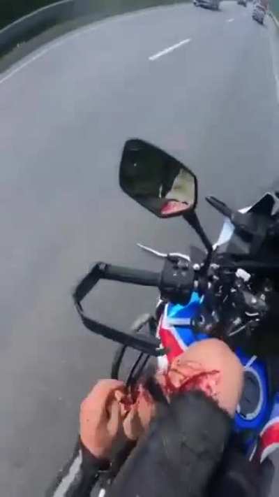 Motorcyclist clips car and gets his foot shredded.