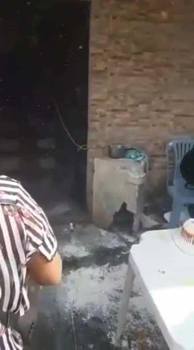 First degree burns for a birthday celebration