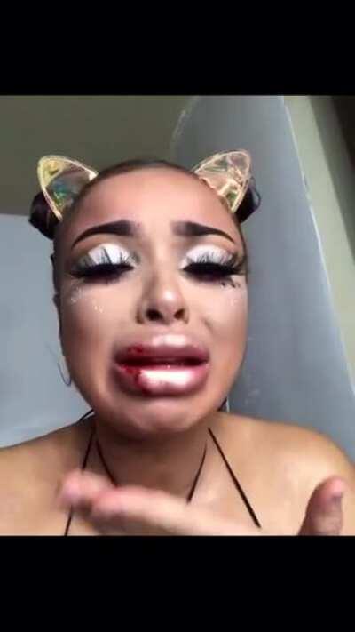 (BLOODY) girls lips popped after doing her makeup