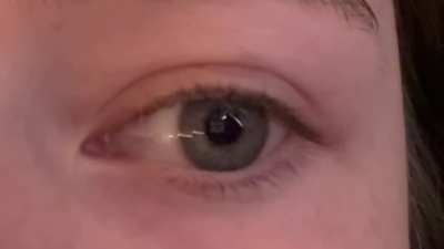 I can constrict my pupils on cue