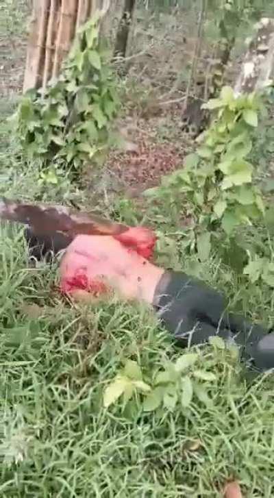 #11 ALL OF them from r/eyeblech r/MakeMyCoffin r/NSFL__