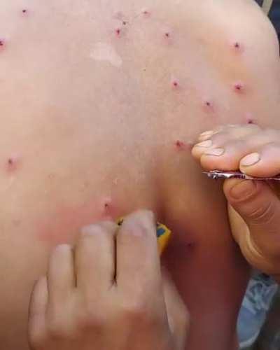 Shia Mourners showered with pellets by the Indian police.