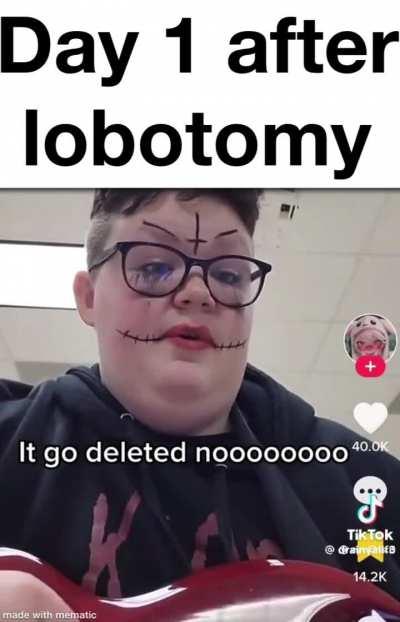 Lobotomy