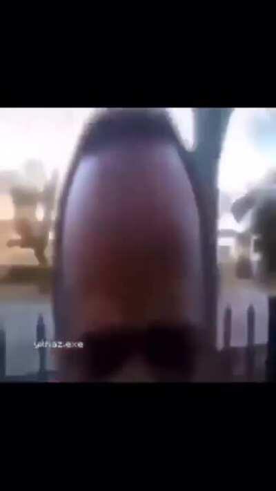 Number 15 Burger King foot fungus