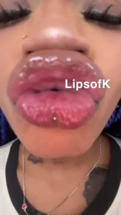  lipsofk here yall go pathetic 