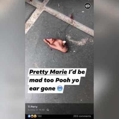 She bite her ear off during a fight