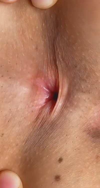 My asshole is ready to become yours ;)