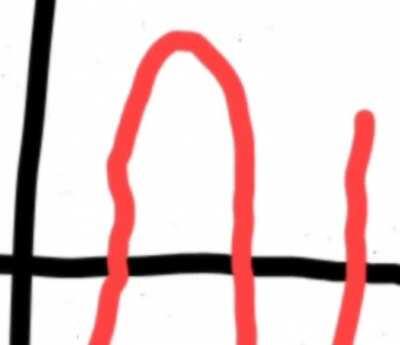 Spm maths paper 2 question 12