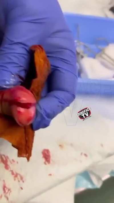 Bruh almost lost his finger 🤯 #grindfacetv @ jaymal.1