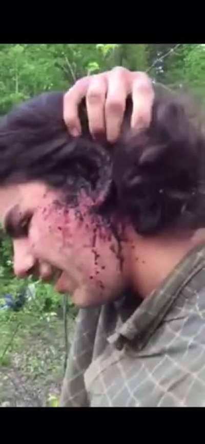 Bugs in northern Ontario (Canada) get pretty bad