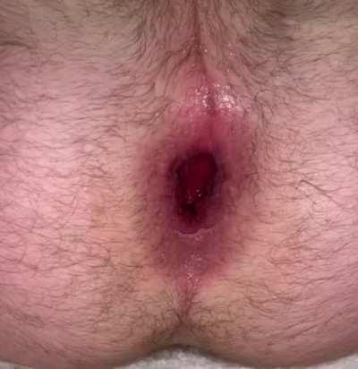 Pink little gape