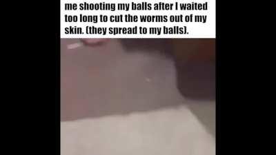 PSA: there are insects living under your skin. Cut them out before they can spread.