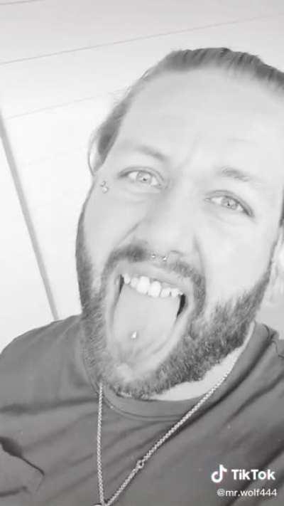 What's the worst thing about this situation? The teeth? The crazy eyes? The dandruff on his shirt? Voting is now open