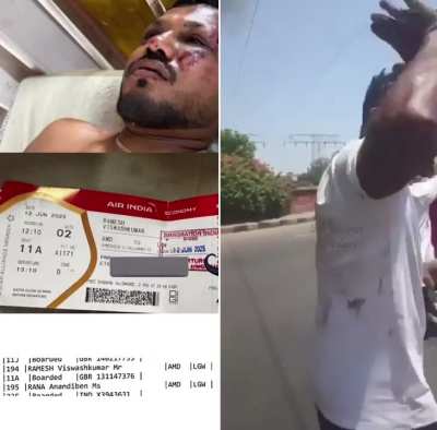 Ramesh Vishwaskumar , sole survivor of plane crash 787 Air India. He was in seat 11A. Miracle that this man is alive.