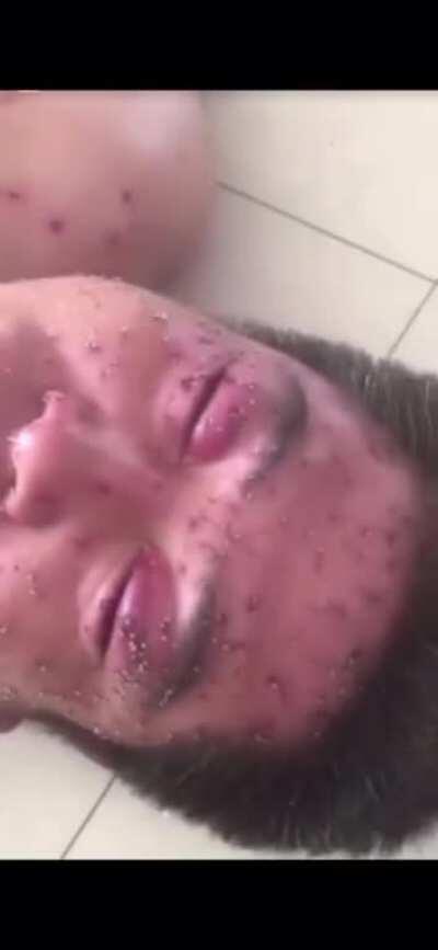 This was a losing battle from the start