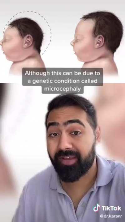 The rat children of Pakistan.