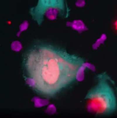 Visuals of killer t cells killing cancer cells.