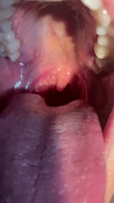 So tiny, I won't even feel you sliding into my stomach. {f}