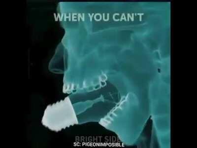 I’m 15 and this is yeet