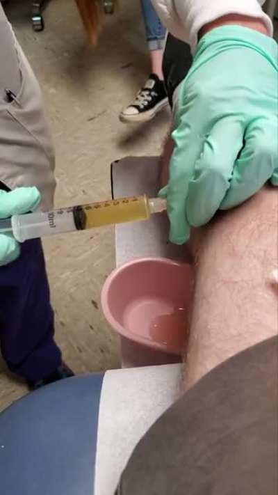 It just keeps coming...