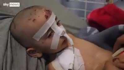 Unfortunately, on Friday, 3-year-old Arslan Berri, the only survivor of his family, who was rescued by the White Helmets in #Idlib, Syria, passed away due to crush syndrome, a condition that unfortunately affects many who are rescued from under the earthq