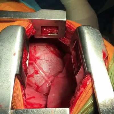 This individual is lucky to have their heart in the right place.